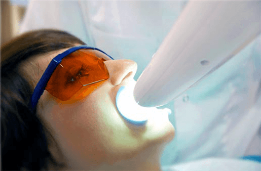 Understanding the Causes of Teeth Sensitivity Ellesmere Port