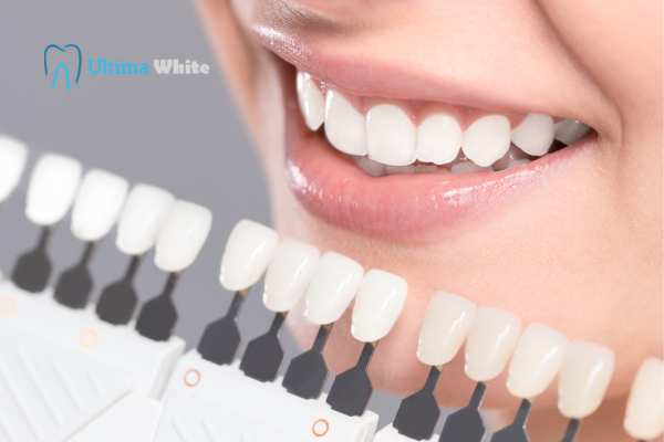 How to Maximise the Results of Your Laser Teeth Whitening Treatment Ellesmere Port