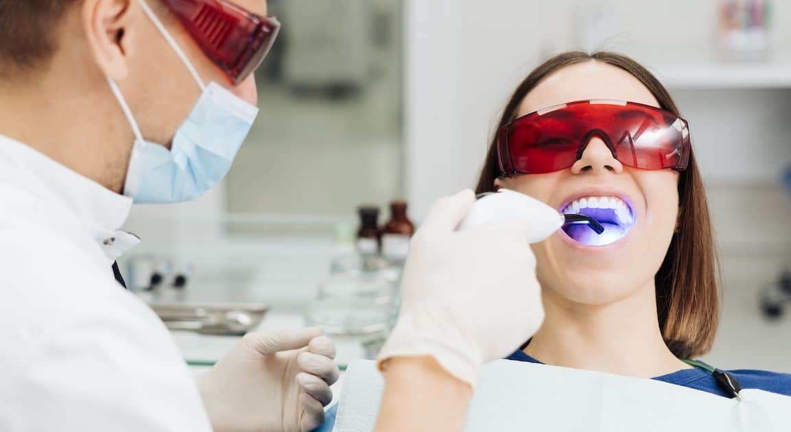 Do Dental Crowns Change Colour After Teeth Whitening Ellesmere Port?