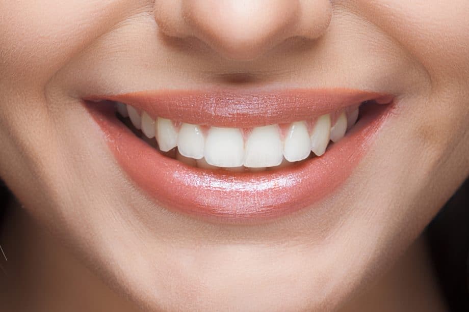 Beyond Whitening: How Your Daily Diet Affects Long-Term Smile Brightness Ellesmere Port