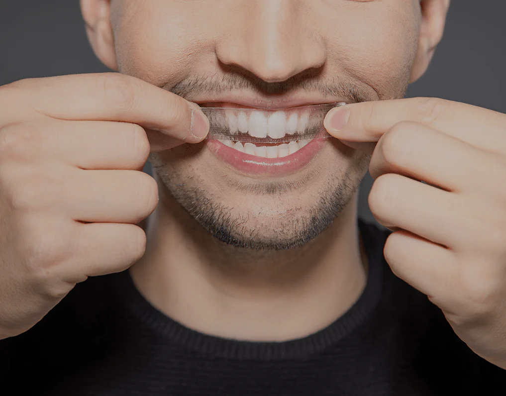 How Are Invisible Aligners Changing Orthodontic Treatments Ellesmere Port?