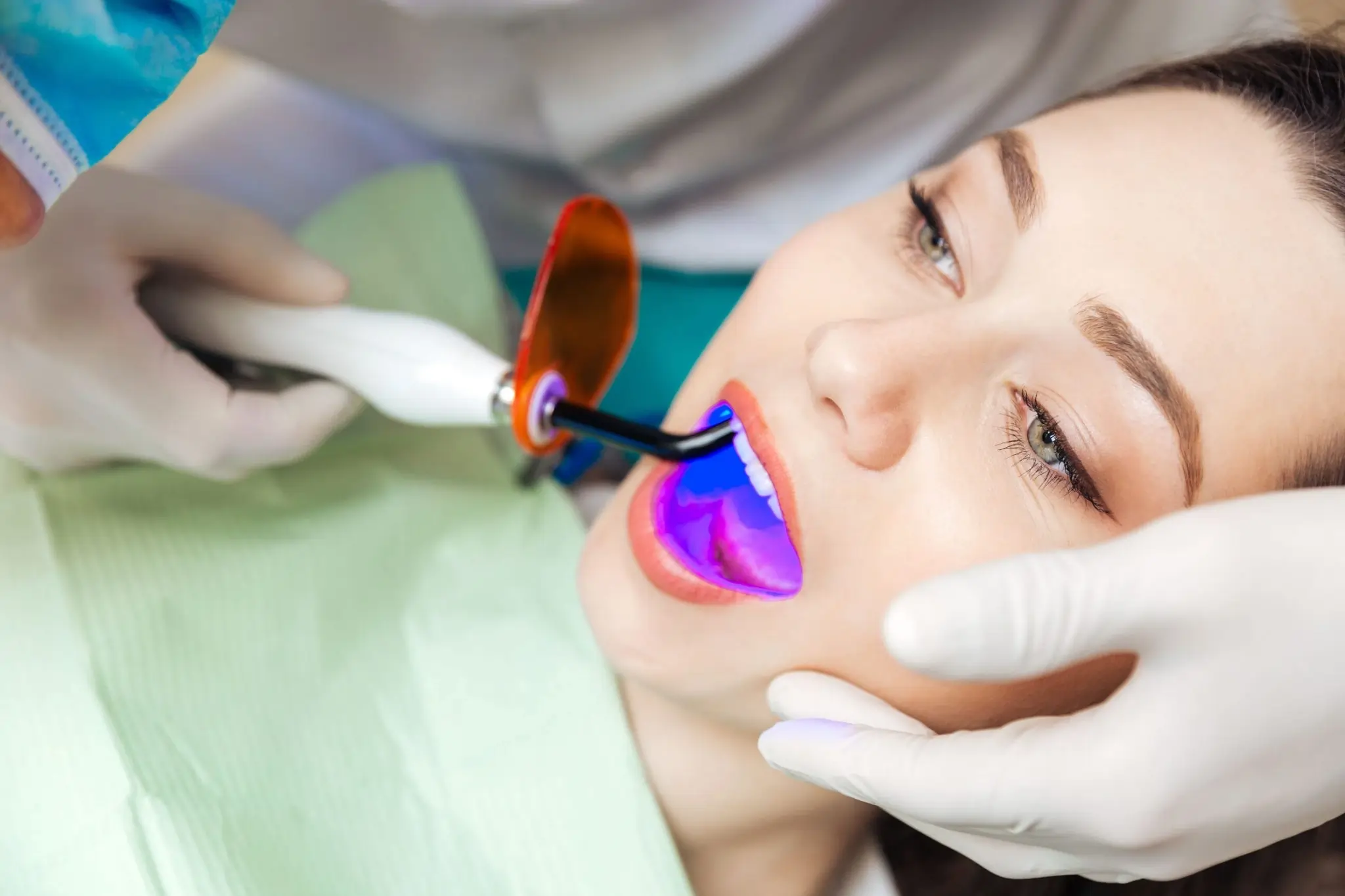 What You Need to Know Before Brightening Your Smile Ellesmere Port