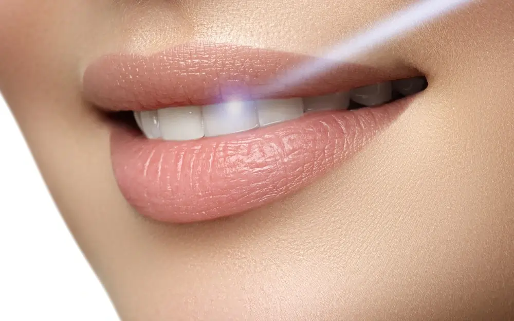 Understanding Teeth Whitening Risks and Results Ellesmere Port
