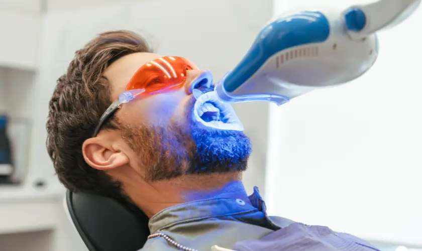 What Is Laser Teeth Whitening and How Does It Work Ellesmere Port?