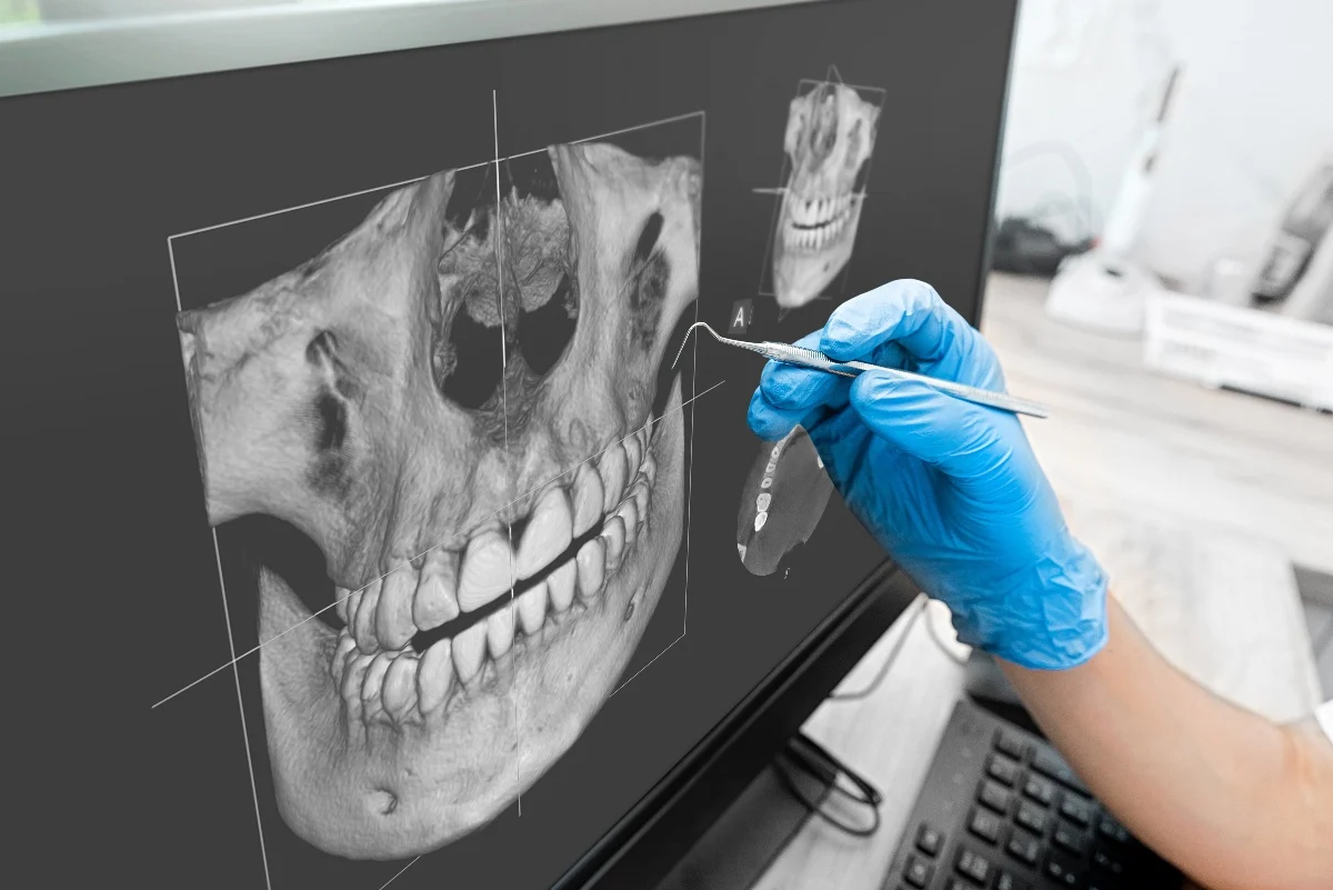Key Benefits of 3D Printing for Patients and Dentists Ellesmere Port