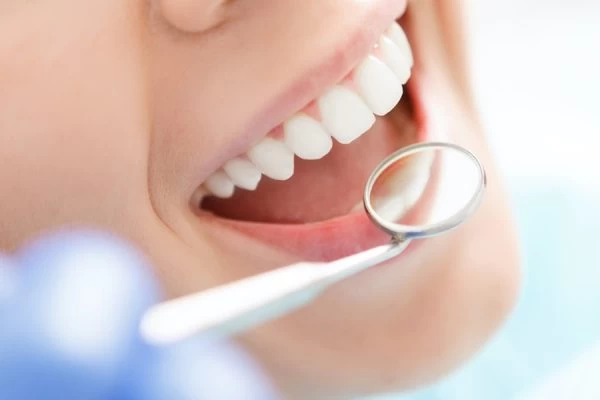 Preventing Complications: Tips for Maintaining Oral Health Ellesmere Port