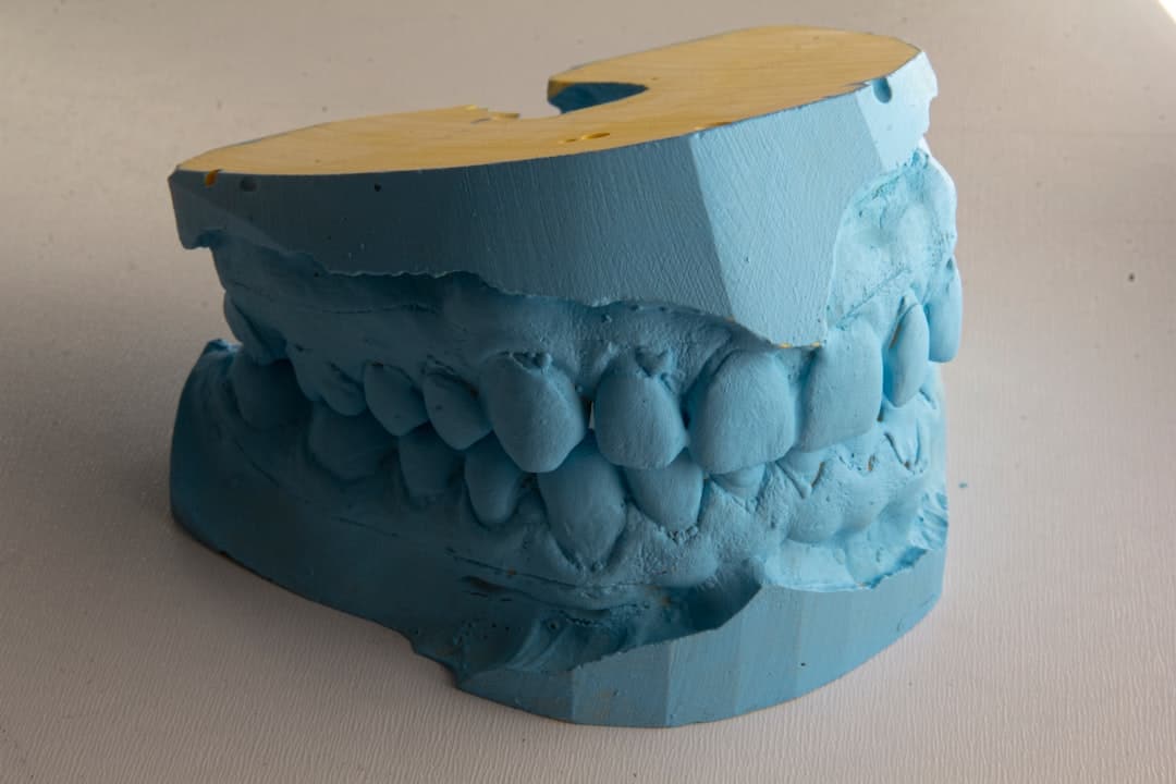 How Do Dental Implants Improve Jawbone Health and Oral Function Ellesmere Port?