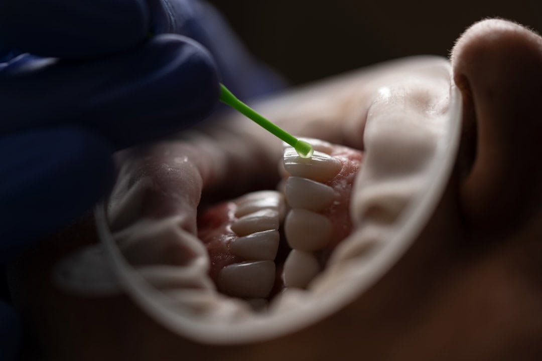How Saliva Protects Your Teeth and Gums Ellesmere Port
