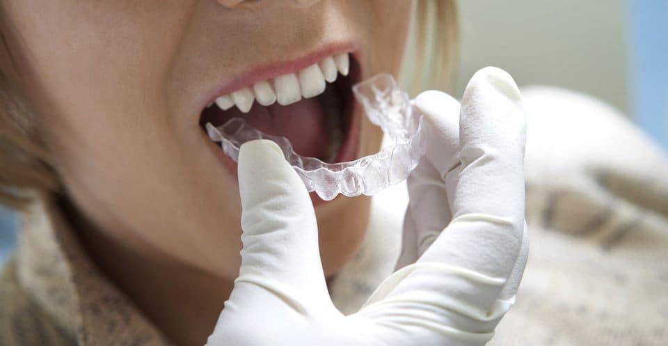 Can Bruxism Affect Your Sleep Quality Ellesmere Port