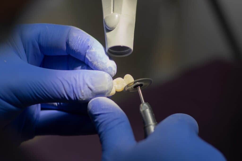 Customised Dental Solutions: Crowns, Aligners, and Implants Ellesmere Port
