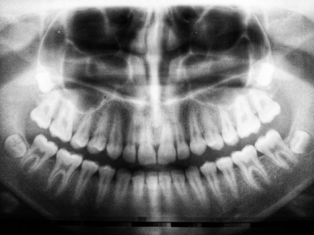 The Future of 3D Printing in Oral Healthcare Ellesmere Port